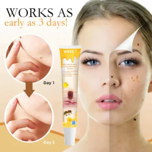 Bee Venom Wart & Tag Removal Cream - Image 5