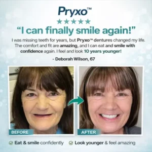 70% off! Complete Dentures - Image 2