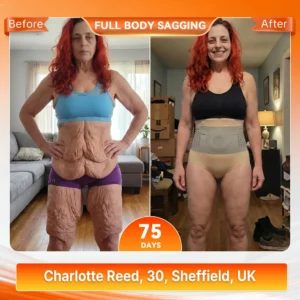 Moringa & Berberine 4-in-1 Advanced Sculpting & Fat-Burn Short - Image 4