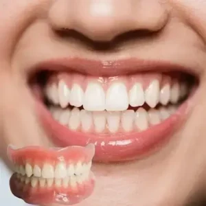 -Ends Today: 70% Custom-Fit Full Functional Dentures Make you more confident - Image 3