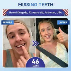 Tooth & Gum Repair - Image 7