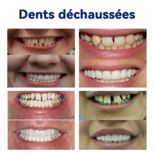 Achetez une deuxième commande avec 30% de réduction💎 - Image 7