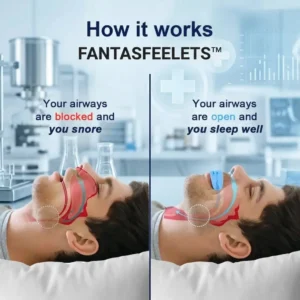 🔥Hot Sale 60% off🔥 Professional intelligent anti-snoring device - Image 3