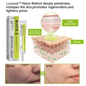 Botox & Retinol Shot - Image 12