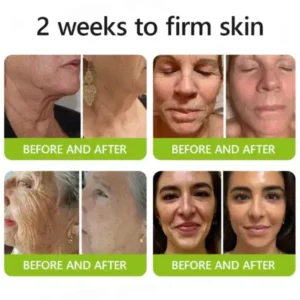 Botox & Retinol Shot - Image 15
