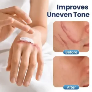 DERMALUX Texture Repair Gel - Image 6