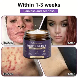 Biotin Cream 2026 | Skin Repair Formula - Image 4