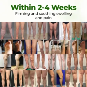 Professional Leg Circulation Cream - Image 4