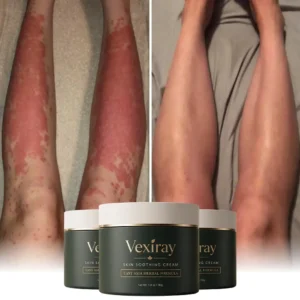 Eczema & Psoriasis Cream - Image 4