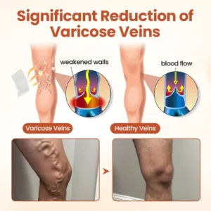 Vein Patch 2026 | Fast Varicose Vein Relief - Image 5