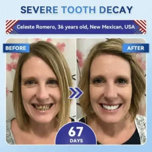 Your Smile~ 🦷 Tideglusib Fast‑Dissolving Tooth & Gum Repair Oral Strips ✨ (𝟓-𝐢𝐧-𝟏 💎 𝐑𝐞𝐛𝐮𝐢𝐥𝐝 𝐄𝐧𝐚𝐦𝐞𝐥 & 𝐃𝐞𝐧𝐭𝐢𝐧 • 𝐒𝐭𝐫𝐞𝐧𝐠𝐭𝐡𝐞𝐧 𝐆𝐮𝐦𝐬 • 𝐄𝐫𝐚𝐝𝐢𝐜𝐚𝐭𝐞 𝐓𝐚𝐫𝐭𝐚𝐫 & 𝐎𝐝𝐨𝐫 • 𝐖𝐡𝐢𝐭𝐞𝐧𝐢𝐧𝐠 • 𝐒𝐭𝐨𝐩 𝐓𝐨𝐨𝐭𝐡 𝐒𝐞𝐧𝐬𝐢𝐭𝐢𝐯𝐢𝐭𝐲) - Image 3