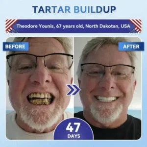 Your Smile~ 🦷 Tideglusib Fast‑Dissolving Tooth & Gum Repair Oral Strips ✨ (𝟓-𝐢𝐧-𝟏 💎 𝐑𝐞𝐛𝐮𝐢𝐥𝐝 𝐄𝐧𝐚𝐦𝐞𝐥 & 𝐃𝐞𝐧𝐭𝐢𝐧 • 𝐒𝐭𝐫𝐞𝐧𝐠𝐭𝐡𝐞𝐧 𝐆𝐮𝐦𝐬 • 𝐄𝐫𝐚𝐝𝐢𝐜𝐚𝐭𝐞 𝐓𝐚𝐫𝐭𝐚𝐫 & 𝐎𝐝𝐨𝐫 • 𝐖𝐡𝐢𝐭𝐞𝐧𝐢𝐧𝐠 • 𝐒𝐭𝐨𝐩 𝐓𝐨𝐨𝐭𝐡 𝐒𝐞𝐧𝐬𝐢𝐭𝐢𝐯𝐢𝐭𝐲) - Image 4