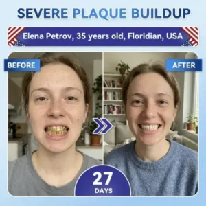 Your Smile~ 🦷 Tideglusib Fast‑Dissolving Tooth & Gum Repair Oral Strips ✨ (𝟓-𝐢𝐧-𝟏 💎 𝐑𝐞𝐛𝐮𝐢𝐥𝐝 𝐄𝐧𝐚𝐦𝐞𝐥 & 𝐃𝐞𝐧𝐭𝐢𝐧 • 𝐒𝐭𝐫𝐞𝐧𝐠𝐭𝐡𝐞𝐧 𝐆𝐮𝐦𝐬 • 𝐄𝐫𝐚𝐝𝐢𝐜𝐚𝐭𝐞 𝐓𝐚𝐫𝐭𝐚𝐫 & 𝐎𝐝𝐨𝐫 • 𝐖𝐡𝐢𝐭𝐞𝐧𝐢𝐧𝐠 • 𝐒𝐭𝐨𝐩 𝐓𝐨𝐨𝐭𝐡 𝐒𝐞𝐧𝐬𝐢𝐭𝐢𝐯𝐢𝐭𝐲) - Image 7