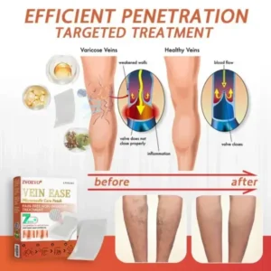 Vein Ease Microneedle Care Patch - Image 10
