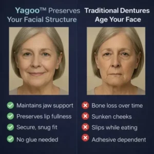 2026🏆✨LAST DAY SALE 60% OFF🔥 Newly upgraded second-generation complete dentures - Image 7