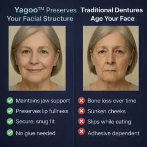 2026🏆✨LAST DAY SALE 60% OFF🔥 Newly upgraded second-generation complete dentures - Image 7