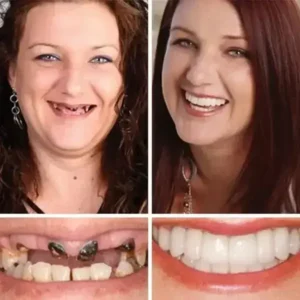 Agrapaws Premium Denture - Image 10