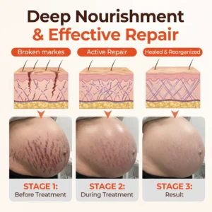 SilkStretch Natural Stretch Mark & Scar Oil - Image 3