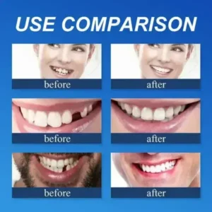 Custom-Fit Full Denture 2026 | Strong Suction Moldable Denture Set - Image 5