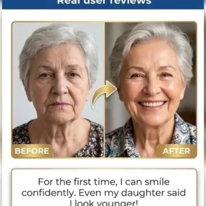 🏆Ends Today: 70% OFF! 🏆2026 Bestselling Product🦷 Fit for a Fresh Smile, Say Goodbye to Wearing Discomfort! - Image 5