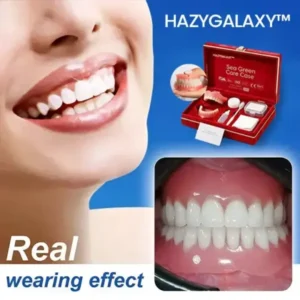 Alternative view of -Ends Today: 70% OFF! Full Denture with Strong Suctiond Custom-Fit Full Functional Dentures🦷