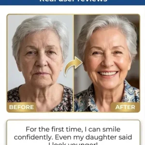 Premium Denture 2026 | Secure Custom Fit - Image 6