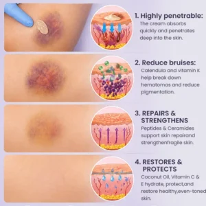 Bruise Repair & Skin-Strengthening Cream - Image 11