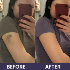 Bruise Repair & Skin-Strengthening Cream - Image 12