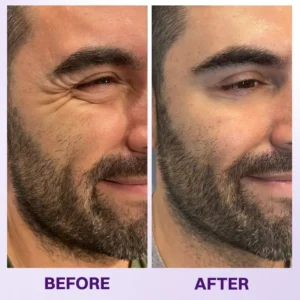 Instant Lift Eye Gel - Image 11