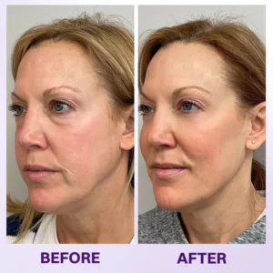 Instant Lift Eye Gel - Image 15