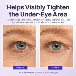 Instant Lift Eye Gel - Image 9