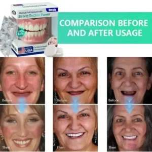 🔥Limited Time 50% OFF： 2nd ltem 60% Full Denture with Strong Suction ✅ Made and Shipped from the USA🍀 - Image 2
