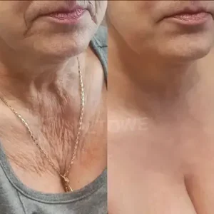Powerful All-Body Skin Treatment Cream - Image 4