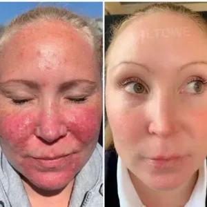 Powerful All-Body Skin Treatment Cream - Image 5