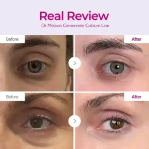 Calcium Eye Cream | Dark Circle Repair - Image 13