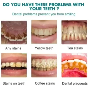 Skavix Tooth Polish | Instant White Smile - Image 6