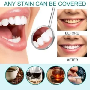 Skavix Tooth Polish | Instant White Smile - Image 7
