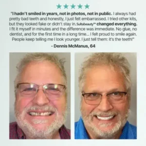 Full Denture - Image 2