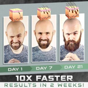 BeardBorn Growth Spray - Image 8
