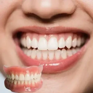 Advanced Functional Dentures - Image 3