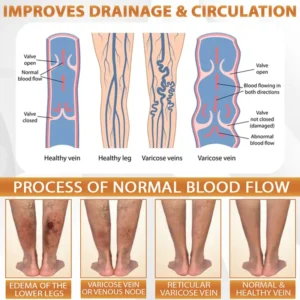 MicroSting Bee Vein Ease Patches - Image 13