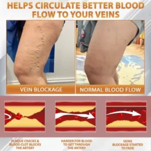 MicroSting Bee Vein Ease Patches - Image 11