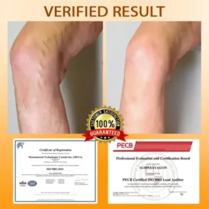 MicroSting Bee Vein Ease Patches - Image 7