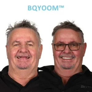 GelFit Dentures - Image 4