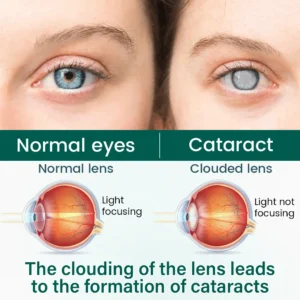 BalanceVie OptiClear Nano Eye Roller Serum - Image 4