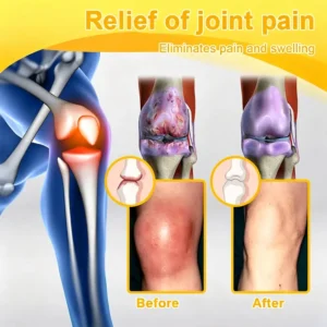 Bellevery Joint Comfort Support Patch - Image 12