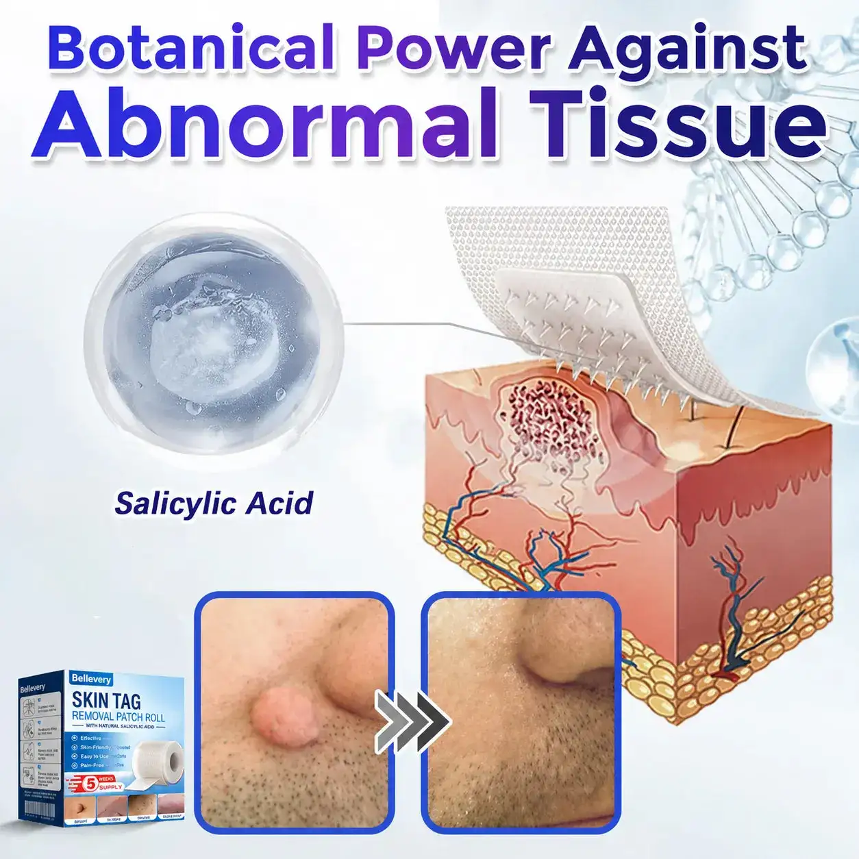 Bellevery Microneedle Patch Roll - Image 6