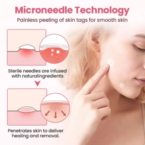 Painless Micro Wart Removal Patch - Image 4