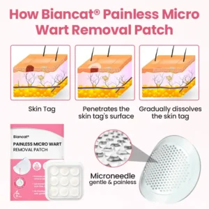 Painless Micro Wart Removal Patch - Image 8