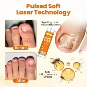 FungiFix Bee Venom Nail Spray - Image 6